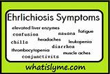 Bartonella Symptoms Mayo Clinic Photos