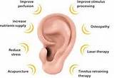Images of Tinnitus Doctor Nyc