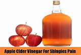 Shingles Home Remedies Apple Cider Vinegar