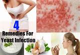 Garlic Home Remedies For Yeast Infection Pictures
