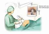 Pictures of Visionaire Knee Replacement Recovery