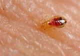 Bed Bug Treatment Natural Images