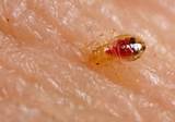 Pictures of Is It Bed Bugs