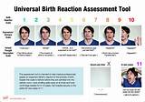 Universal Pain Assessment Tool Pictures