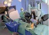 Photos of Robot Surgery