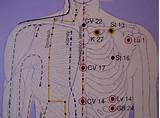 Acupuncture Treatment For Wheezing