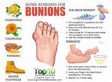 Cure Bunions Home Remedies Pictures