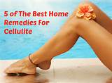 Cellulite Reduction Home Remedies Images