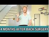 L5 S1 Herniated Disc Surgery Recovery Time
