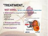 Vitamin Therapy For Macular Degeneration Photos
