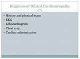 Images of Management Of Dilated Cardiomyopathy