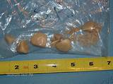 Dog Bladder Stones Surgery Recovery Photos