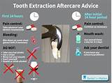 Tooth Extraction Recovery Timeline Photos