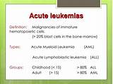 Acute Myeloid Leukemia Life Expectancy Without Treatment