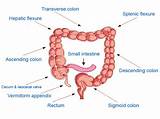 Excessive Gas And Colon Cancer
