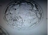 Photos of Fertility Clinic Cells