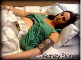 Photos of How Do Doctors Diagnose Kidney Stones