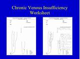 Chronic Venous Insufficiency Treatment Options Pictures
