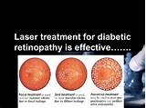 Dr Prasad Diabetes Treatment Images