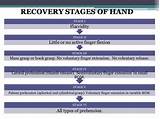 Pictures of Stroke Recovery Time Scale