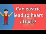 Is Gas A Sign Of Heart Attack Images