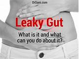 Leaky Gut Doctor
