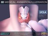 3d Medical Animation Images