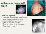 Images of Rotator Cuff Surgery Recovery Exercises