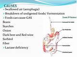 Causes For Excessive Intestinal Gas Photos