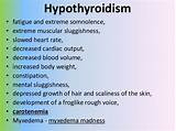 Hypothyroidism And Gas Images