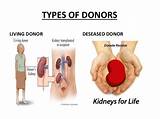 Living Kidney Donor Recovery Images