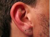 Images of Ear Piercing Doctor