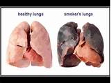 What Are The Side Effects Of Smoking Tobacco