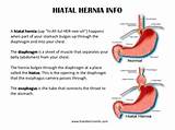 What Type Of Doctor Does Hernia Surgery