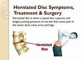 Home Treatment For Herniated Disc In Lower Back Photos