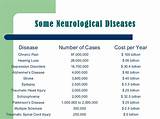 Neurological Disorders Symptoms And Treatments Pictures