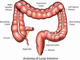 Images of Excessive Gas And Colon Cancer