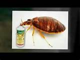 Images of How To Get Rid Of Bed Bugs In A