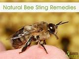 Home Remedies For Bumble Bee Sting Pictures