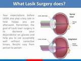 Lasik Candidates For Surgery