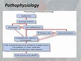 Images of Depression Pathophysiology