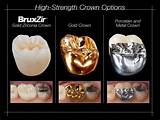 Images of Dental Gold Crown