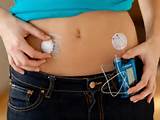Pictures of What Is An Insulin Pump