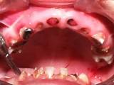 Photos of Sodas Effect On Teeth