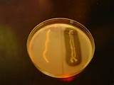 How Does Hydrogen Chloride Kill Bacteria Photos