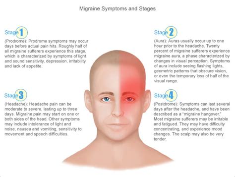 Images of Migraine Headache On Right Side Of Head