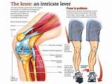 Pictures of Knee Pain Exercises