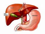 Images of Gall Bladder Symptoms Gas Bloating