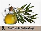 Images of Skin Tags Home Remedies Tea Tree Oil