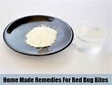 Pictures of Bed Bug Treatment Natural Remedies